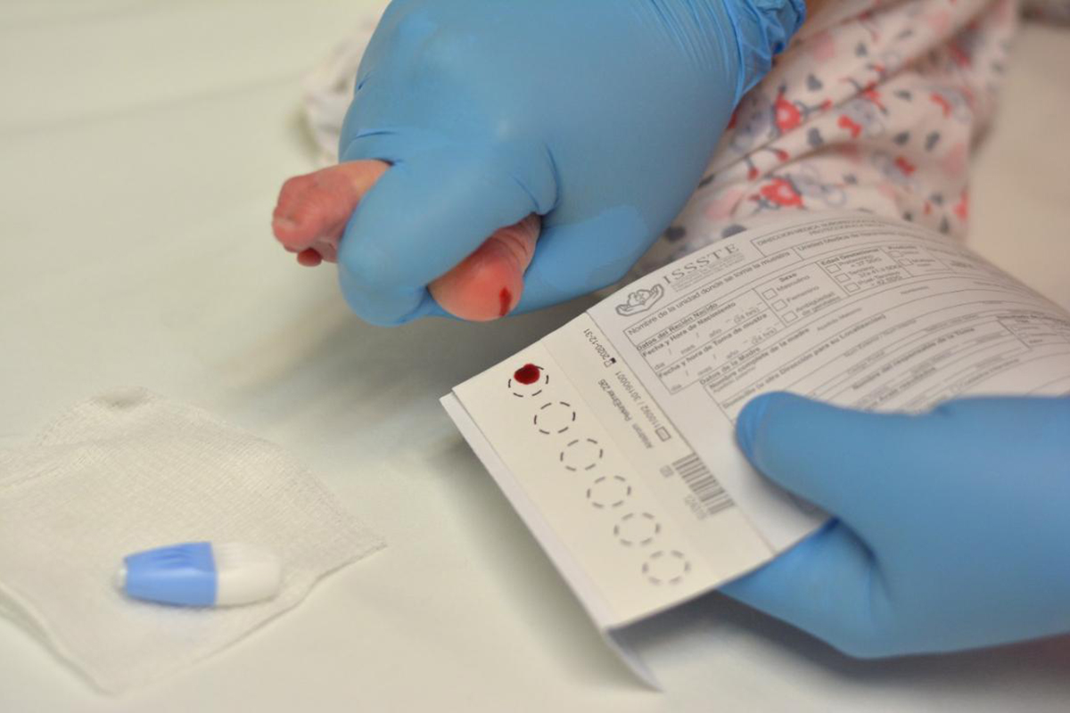 tamiz neonatal, ISSSTE, prueba sangre, niños, recién nacido,