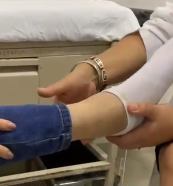 Con injerto óseo, especialistas del IMSS evitan amputación de pie en adolescente