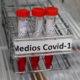 Inician pruebas para detectar influenza y Covid en una sola muestra