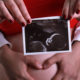 Alertan por “Megalodón Legislativo” que busca despenalizar el aborto hasta los 9 meses