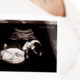 “No hay un día que no extrañe a mi bebé que aborté”, madre escribe experiencia