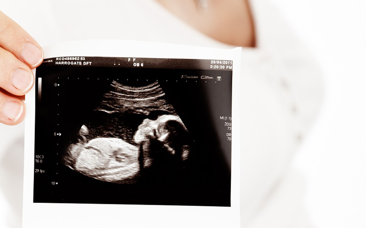 “No hay un día que no extrañe a mi bebé que aborté”, madre escribe experiencia