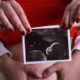 “Un ser humano dentro del vientre materno ya es persona”: Alejandra Yáñez