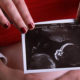Polonia refuerza protección a la vida; Presidente advierte que el aborto es asesinato