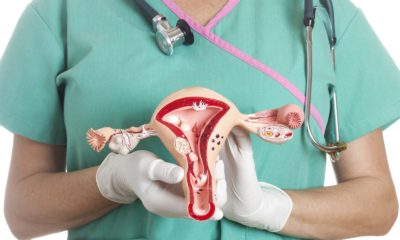 Cáncer Cérvico Uterino