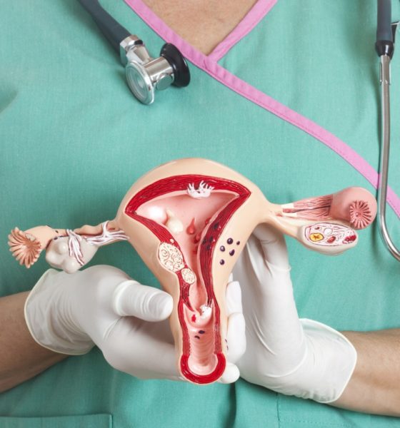 Cáncer Cérvico Uterino