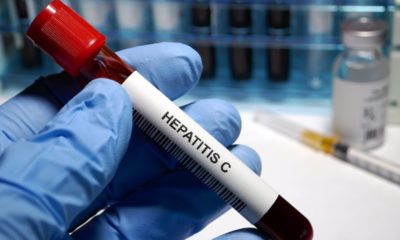 Hepatitis C