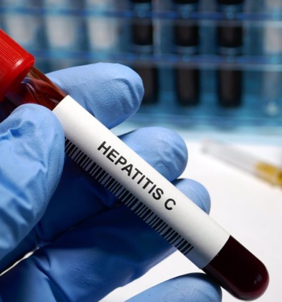 Hepatitis C