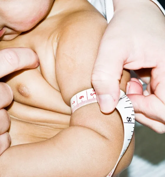 Bebé sobrepeso
