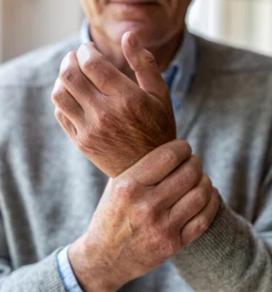 Para 2050, el 37% de los adultos mayores en México podría tener osteoporosis