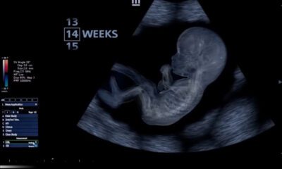 Imágenes inéditas muestran el desarrollo humano desde los primeros días de gestación