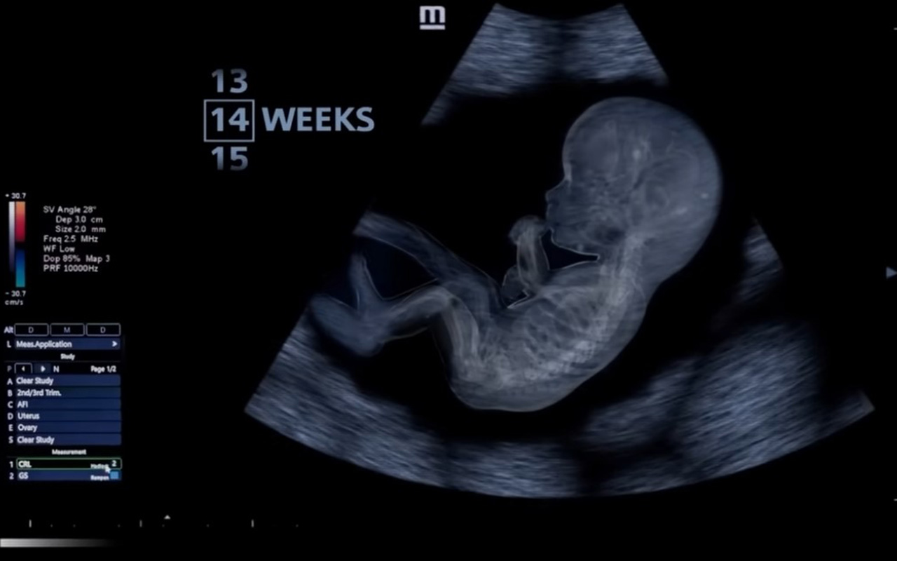 Imágenes inéditas muestran el desarrollo humano desde los primeros días de gestación