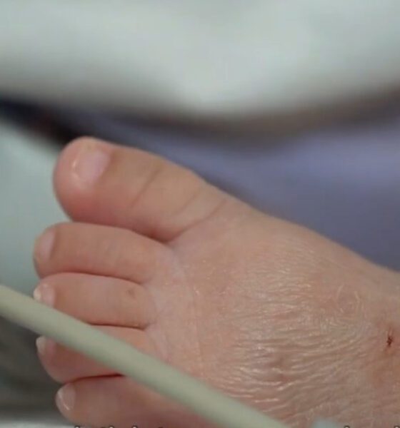 Isabela, la bebé mexicana que nació a las 27 semanas y un solo pulmón