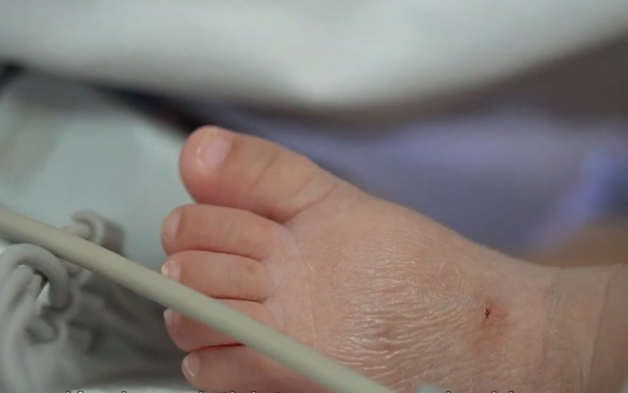 Isabela, la bebé mexicana que nació a las 27 semanas y un solo pulmón