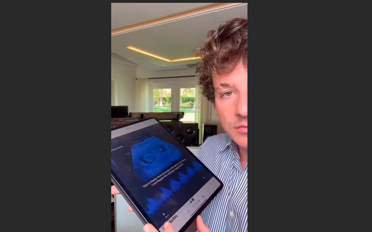 Cantante comparte latidos de su bebé por nacer y descubre el ritmo natural de la vida