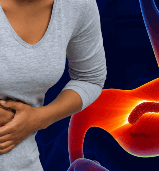 bacteria Helicobacter pylori