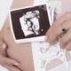 Madre y bebé requieren atención médica conjunta durante el embarazo: especialistas